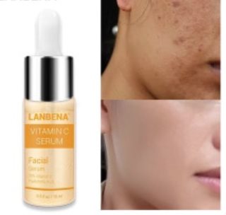 Superserum++ PORE treatment Hyaluronic bli av med synliga pormaskar, reducerar upp till 99%