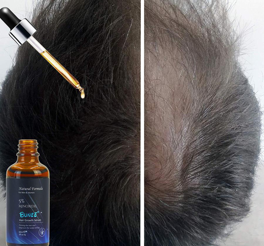 Bunee Hårväxt serum - Hair growth serum - 60ml