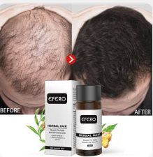 serum HÅR naturligt hair growth